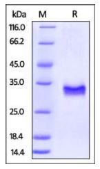 Rhesus macaque CD40, His Tag on SDS-PAGE under reducing (R) condition. The gel was stained overnight with Coomassie Blue. The purity of the protein is greater than 95%.